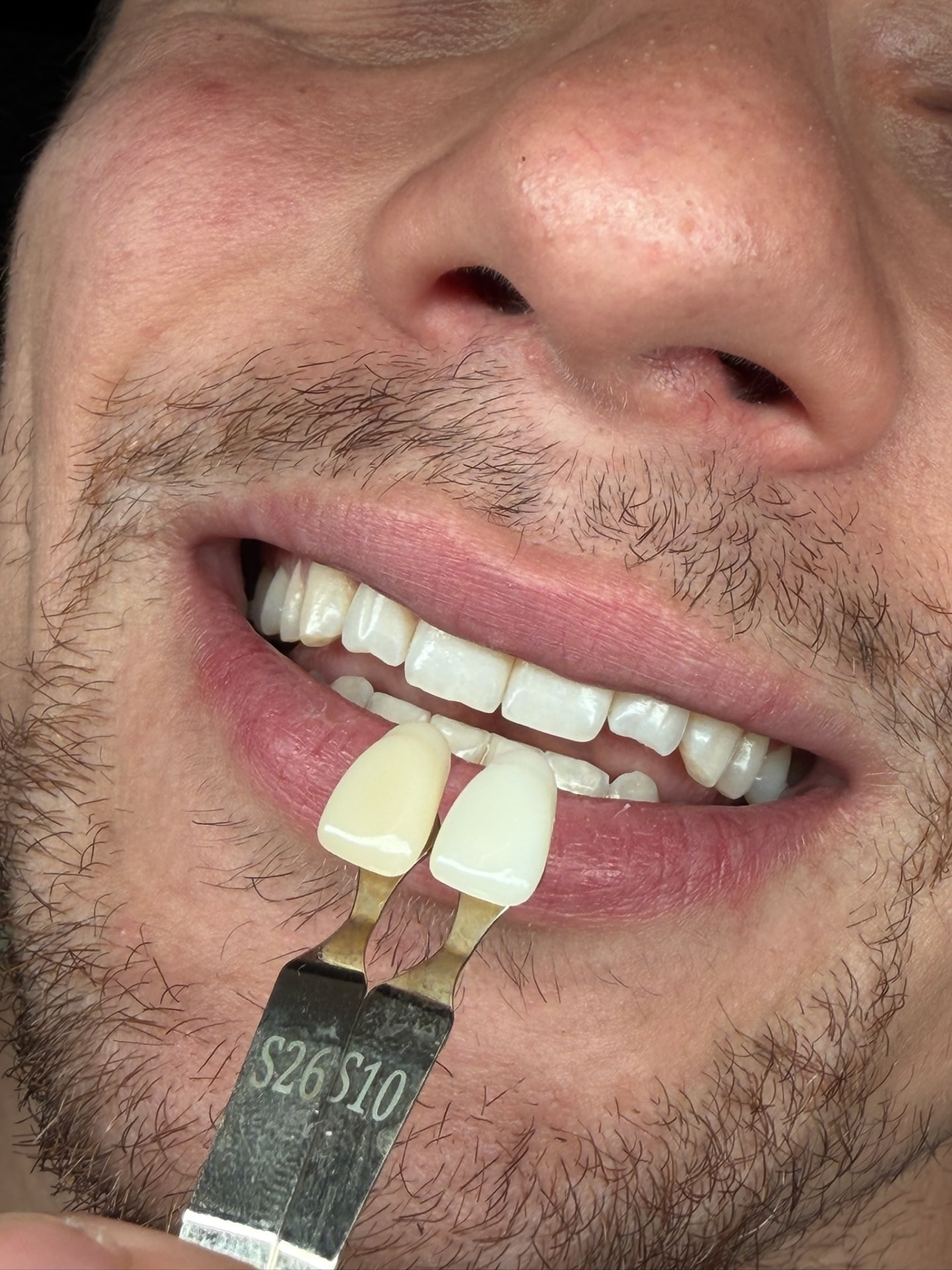 Cosmetic studio result shown close up